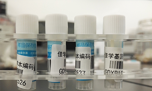 【佳學基因檢測】做Bosch-Boonstra-Schaaf視神經萎縮綜合征基因解碼、<a href=http://hyjhsj.com/tk/jiema/cexujishu/2021/31933.html>基因檢測</a>需要多長時間？