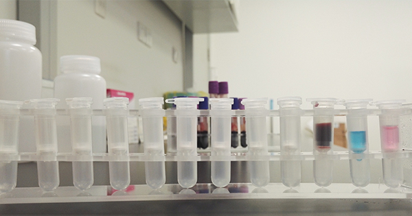 【佳學基因檢測】做尼古丁敏感性-毒性/ADR基因解碼、<a href=http://hyjhsj.com/tk/jiema/cexujishu/2021/31933.html>基因檢測</a>需要多長時間？