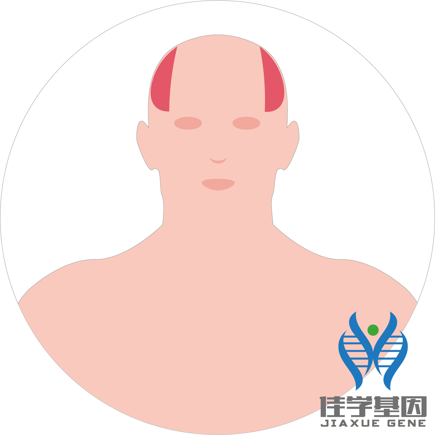 【佳學(xué)基因檢測(cè)】男性<font color='red'>脫發(fā)</font>（Androgenetic alopecia）基因解碼、<a href=http://hyjhsj.com/tk/jiema/cexujishu/2021/31933.html>基因檢測(cè)</a>