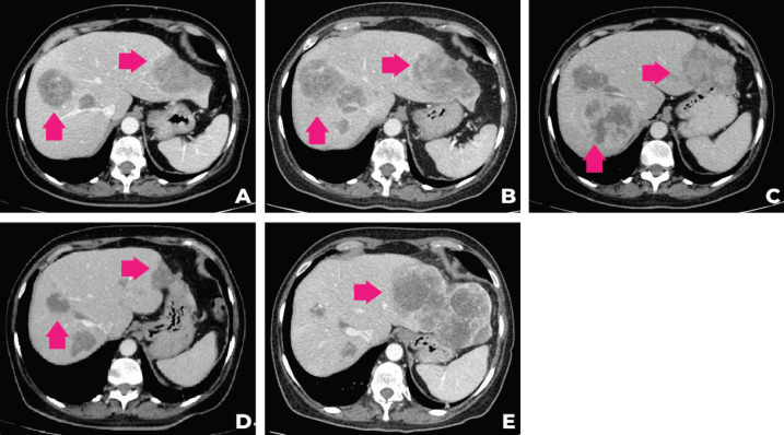 An external file that holds a picture, illustration, etc.
Object name is can-16-1448fig2.jpg