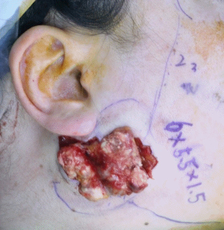 An external file that holds a picture, illustration, etc.
Object name is acfs-2019-00710f4.jpg