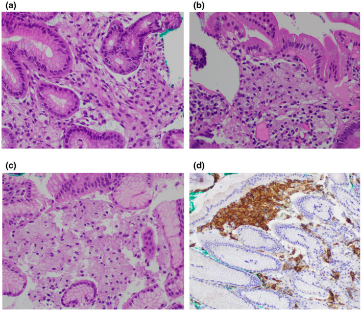 An external file that holds a picture, illustration, etc.
Object name is MGG3-10-e1848-g006.jpg