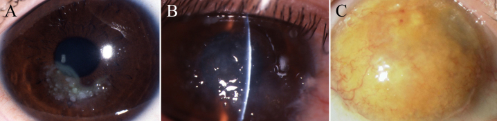 An external file that holds a picture, illustration, etc.
Object name is mv-v17-965-f1.jpg