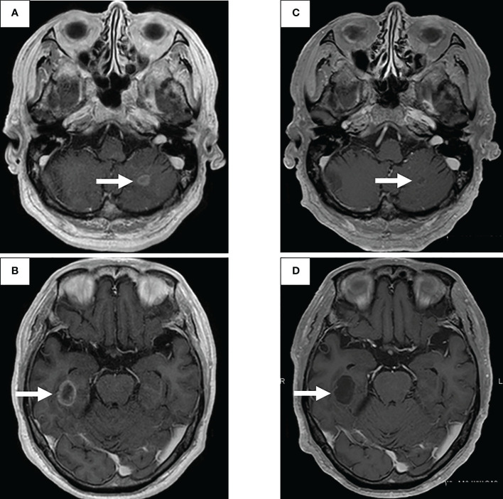 An external file that holds a picture, illustration, etc.
Object name is fonc-12-1019932-g002.jpg