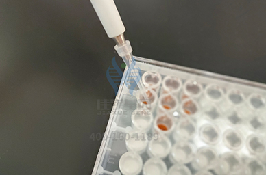 看疾病風(fēng)險評估報告前，需要諳熟于心的CRYGFP知識